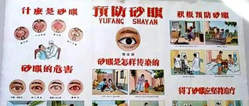 惊悚：六十年前我们怎样治砂眼？